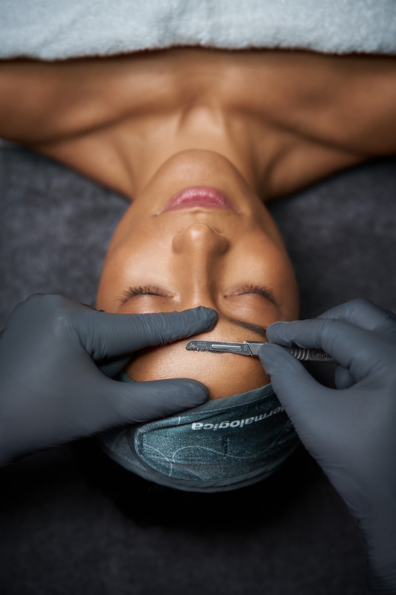 dermaplaning