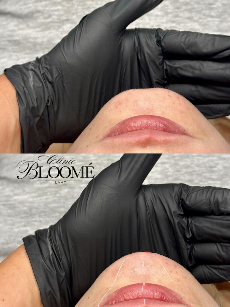 Thumbnail_untitled design 1