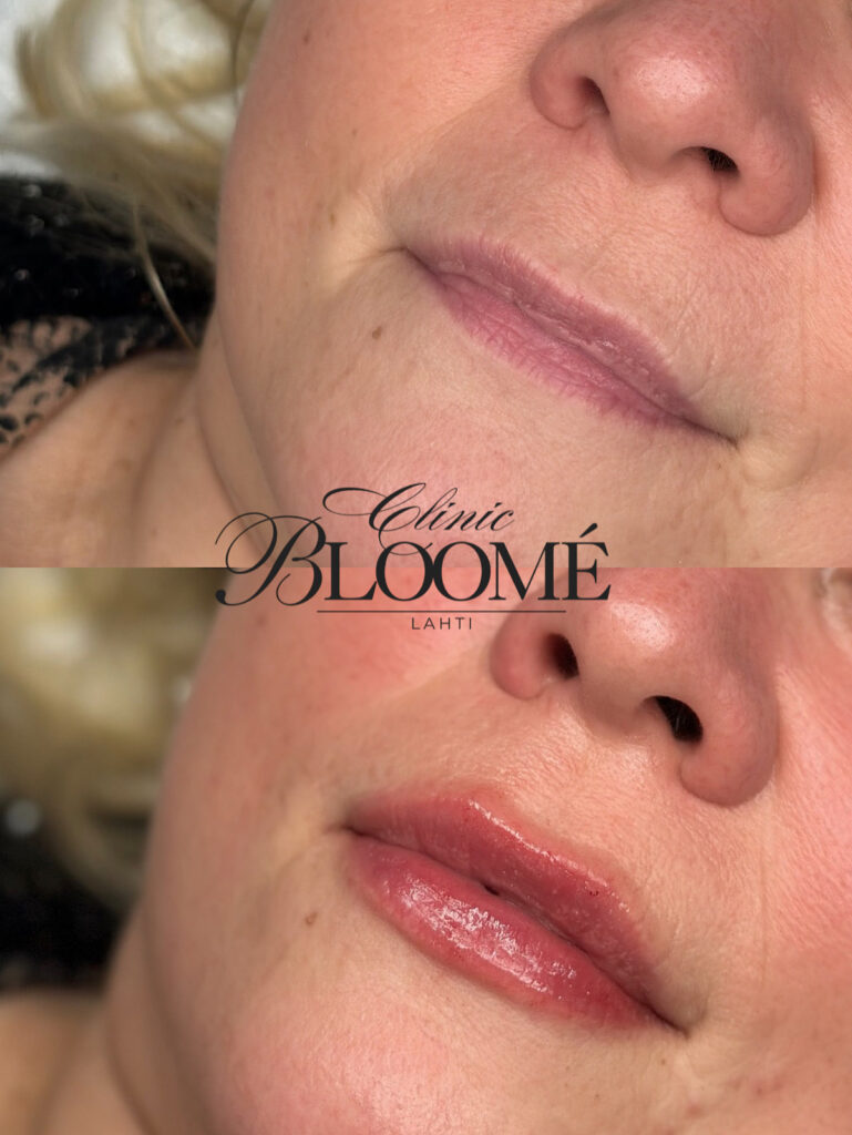 0ac39891 64ed 4df1 b412 a9eceaa2d5bc