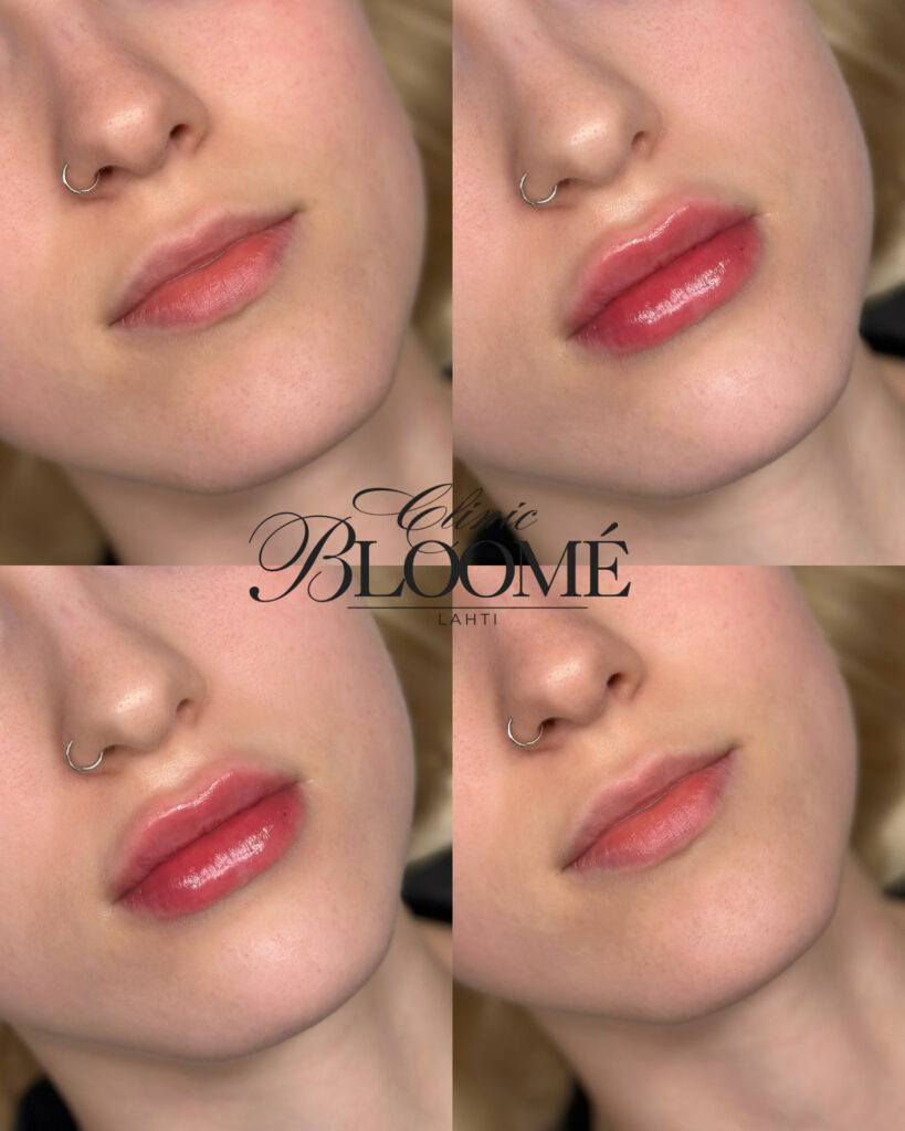 3d49d851 5bd1 40f2 90d0 04a116393d30