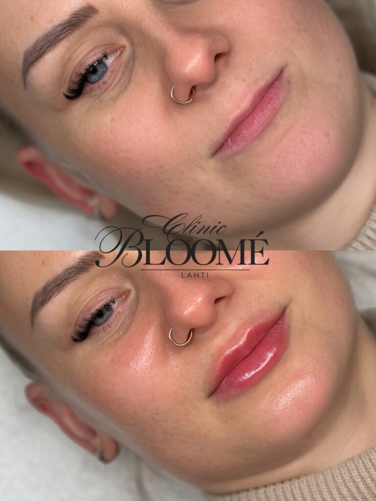 0246881e b06e 409e 8209 8c675b5328aa