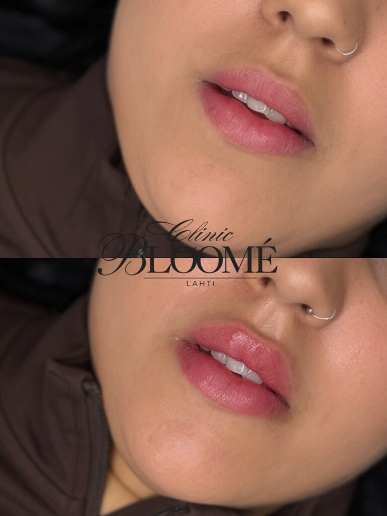 21fd0ec5 cbe8 40a6 acaf 35469a91c106