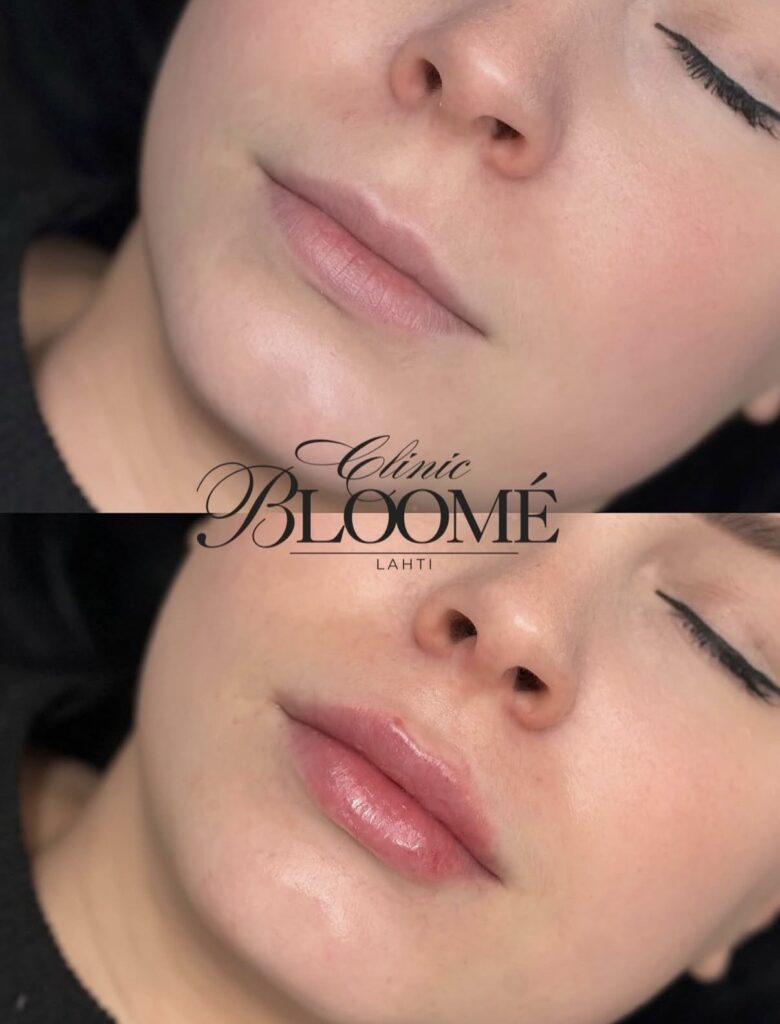 25195b46 ed47 4a44 bfa1 24392ca4fdd8