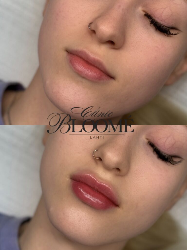 3504c5fd 21ab 4a1b bed0 80b944c2627e