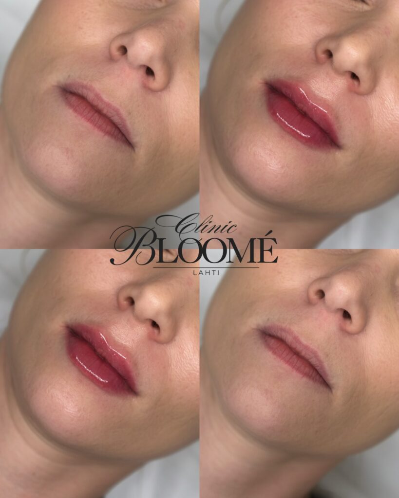 3a5bcc28 b767 4a03 8cbe ea3dc83215ef