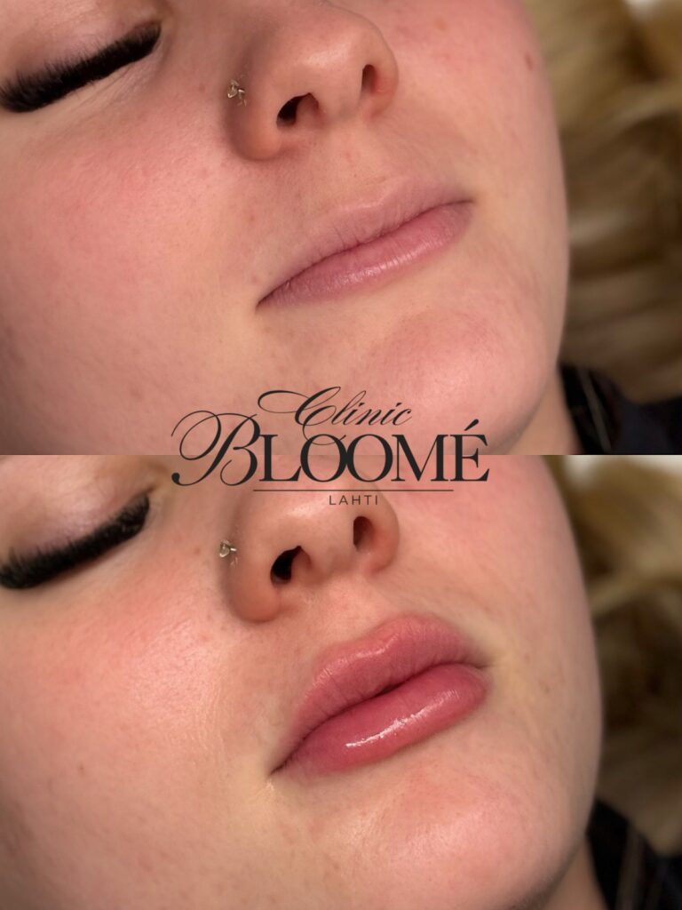 825b3b02 0e66 47d0 81a2 288bfa6ac57b