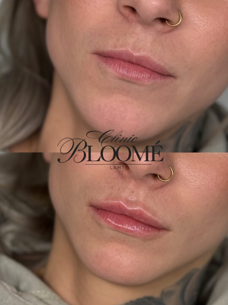 8560edfc d1c0 4082 b7dc 202616f92662