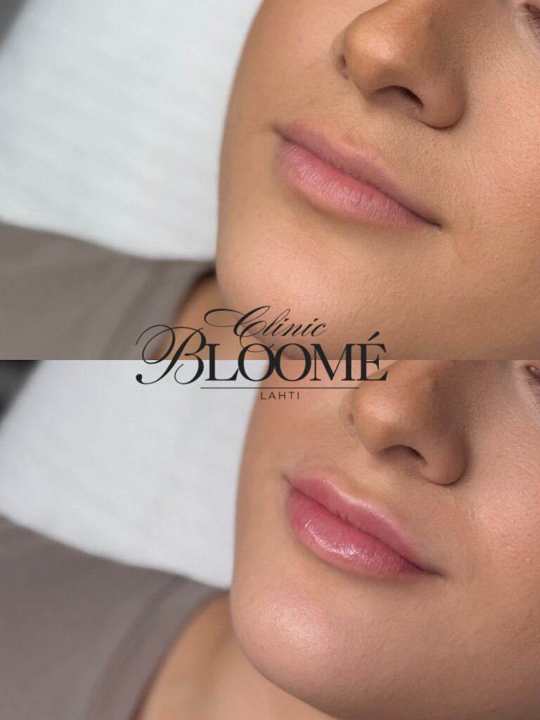 9268bd25 a78e 49e2 9ebd 9ccb1f62e702