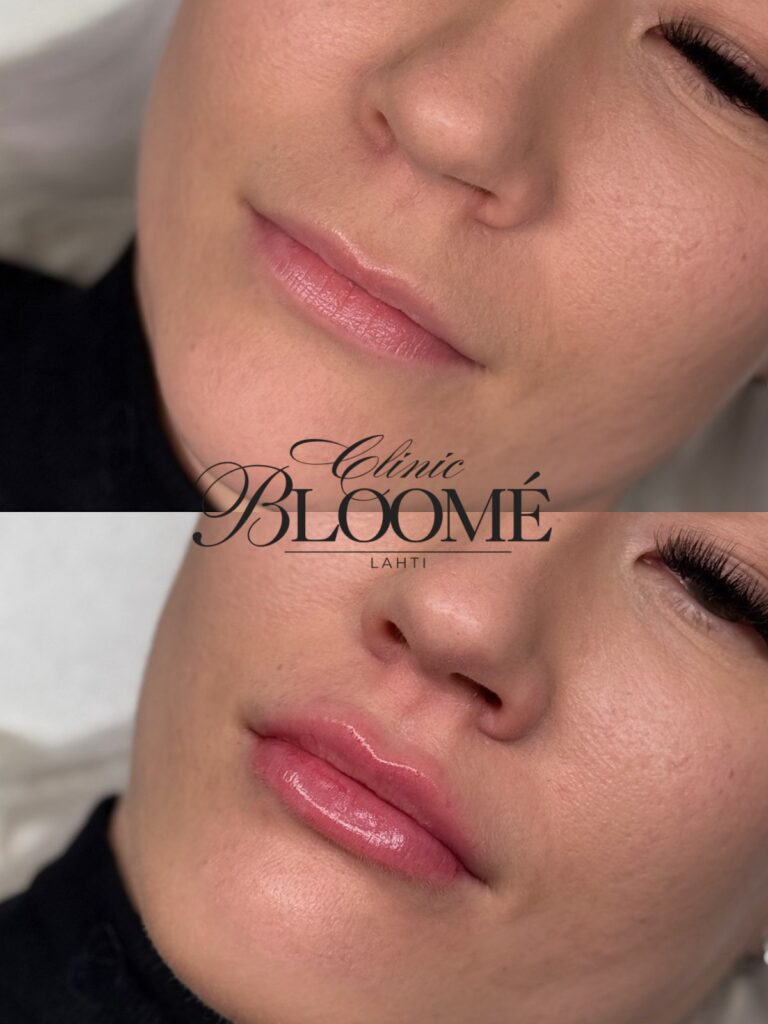 Bea1e4b3 0b6e 4250 8a29 b4884847b7fc