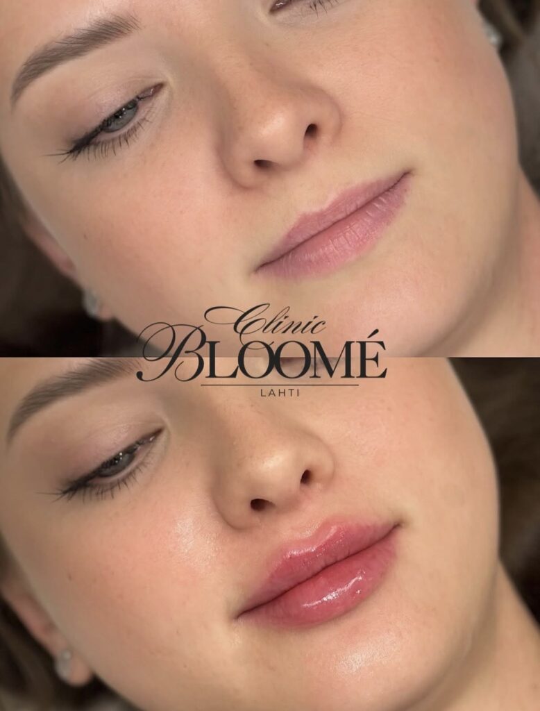 C8eb6b17 bb15 442d 84b6 497d6b060a93