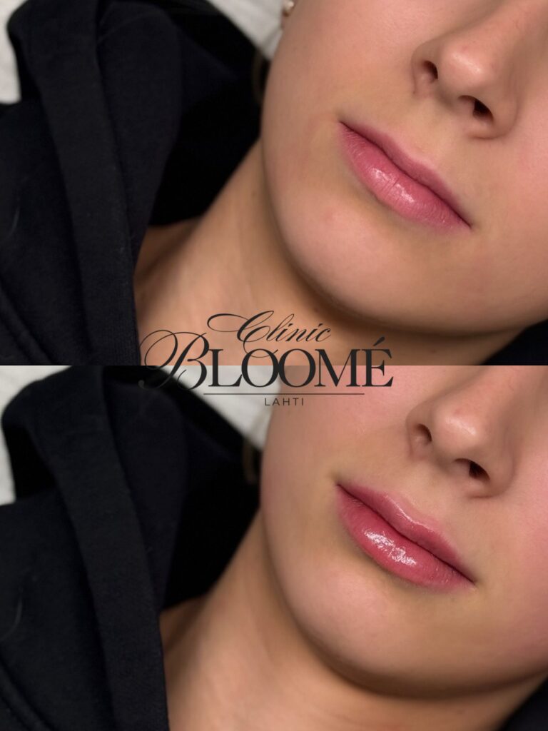 Cf8cd5e5 e618 4d52 8bf7 7a55faa9d30c